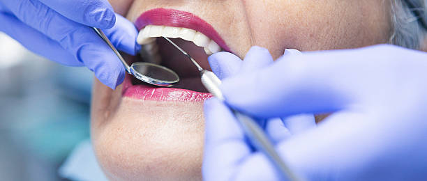 Best Emergency Tooth Extraction in Collinsville, MS